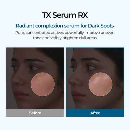 TX Ampoule Rx